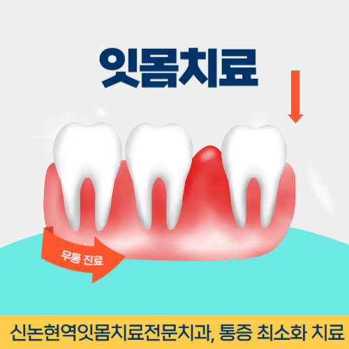 성남치과 성남시 치과 잇몸치료